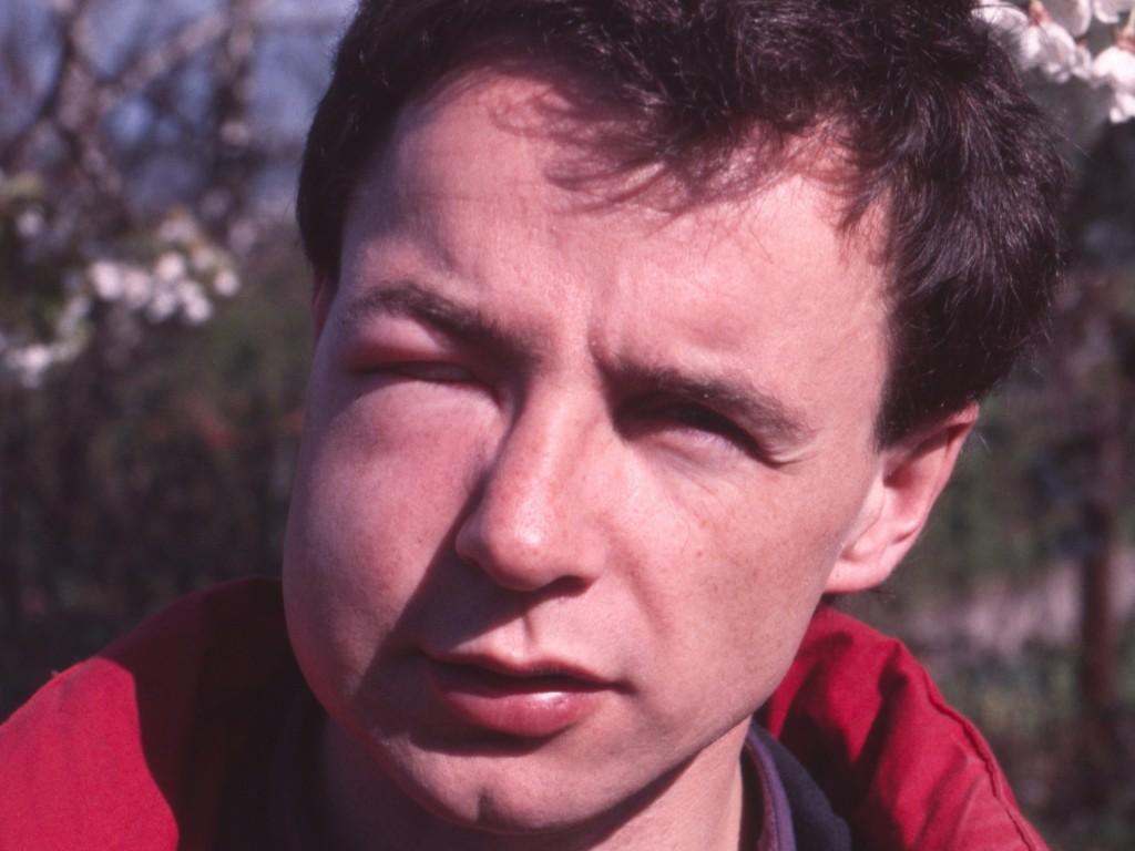 Alle Bienenhalter*innen erwischt es mal - wie hier den Autor Dr. Martin Sch&auml;fer in jungen Jahren. (Foto: Dr. Martin Sch&auml;fer)