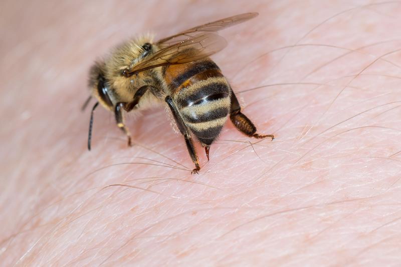 Bei der Bienenstichtherapie werden dem Patienten lebende Bienen auf die Haut gesetzt und zum Stechen provoziert. 